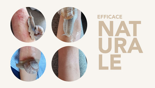 Trattamento naturale con bava di lumaca per una pelle efficace e sana: immagini prima e dopo.