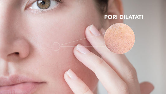 Immagine di pori dilatati sulla pelle, ingrandimento per mostrare la condizione cutanea con pori visibili. Trattamento per pori dilatati con bava di lumaca.