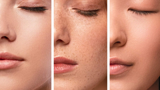 Volti femminili con diversi tipi di pelle e tonalità, per illustrare le differenze cutanee e i trattamenti personalizzati per ogni tipo di pelle del viso