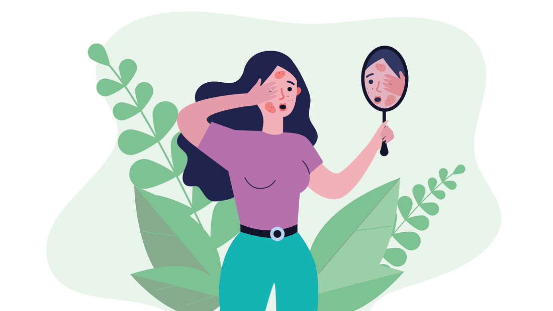 Illustrazione di una donna che guarda il suo riflesso in uno specchio e osserva preoccupata effetti dell'allergia sulla pelle.