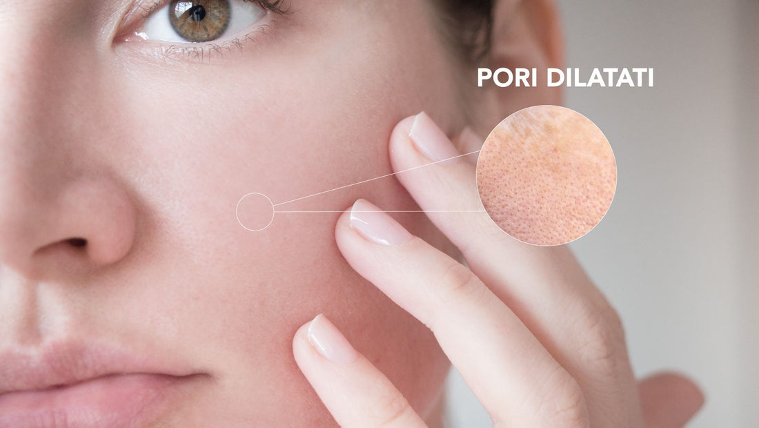 Pori dilatati sul viso e rimedi cosmetici con bava di lumaca naturale